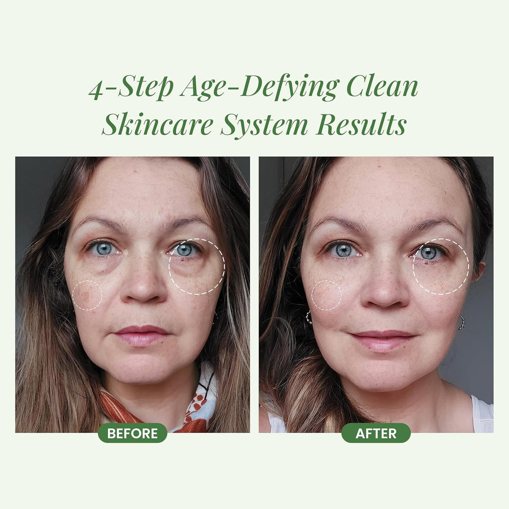 4-Step Skin Care Kit V79442