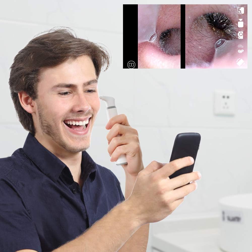 3.9mm WiFi Ear Scope Camera with 6 LED Lights Y730